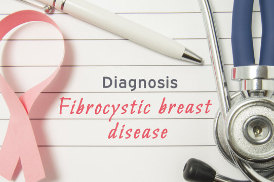 Diagnosis Fibrocystic breast disease. Pink ribbon as symbol of struggle with breast oncology and disorders and stethoscope lying on medical form with text labels Diagnosis Fibrocystic breast disease