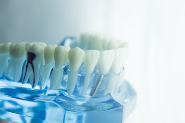 Fototapeta na wymiar Dental teeth dentistry model