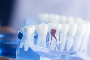 Dental tooth root model