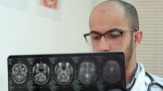 Male radiologist examining brain computed tomography