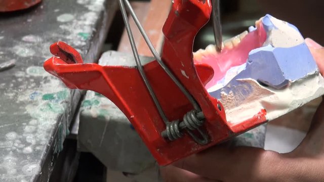 Dentist is applying hot wax into a mold. Dental technologist, the restorations may be formed directly in the mouth or may be cast using the lost-wax technique, such as for some inlays and onlays.