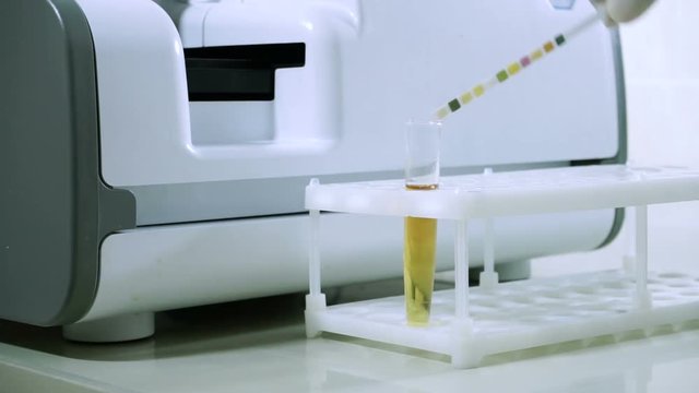 Laboratory analysing of urine. Male laboratory worker conducting a sample of urine at modern equipment. HD