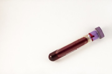 Collection tube blood sample (vacuum) medical test