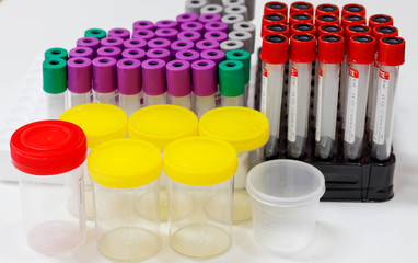 Blood Collection Tube  in Laboratory