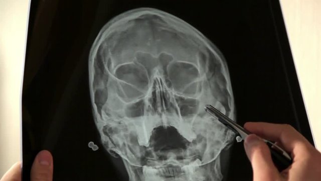 Doctor analyzing human skull x-ray screening image in hospital