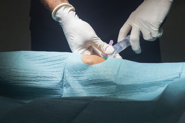 Knee surgery anaesthetic injection