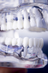 Dentists dental teeth model