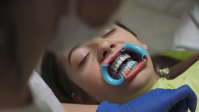 Dentists produce teeth cleaning girl, using tools. 4k footage. Dental clinic. Close-up.