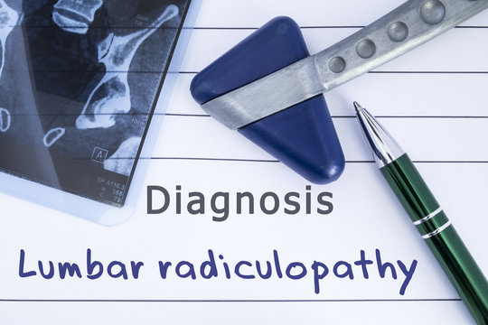 Diagnosis of Lumbar radiculopathy. Medical health history written with diagnosis of Lumbar radiculopathy, MRI image sacral spine and neurological hammer. Medical concept for Neurology, Neuroscience