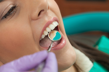 Dentist identifying cavities in mouth of patient