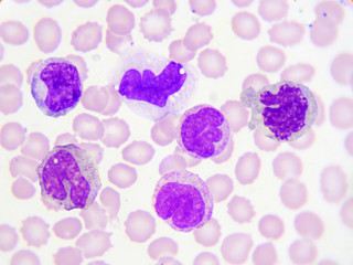 White blood cells in blood smear, Wright stain