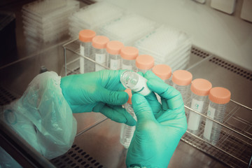 Lab technician takes sample from tube for test, close up