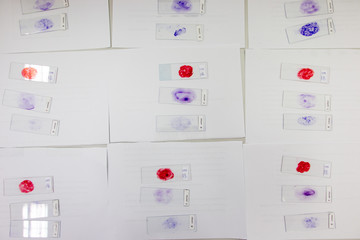 Inoculum for culture on slide in laboratories.