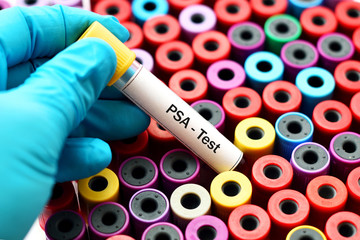 Blood for PSA test