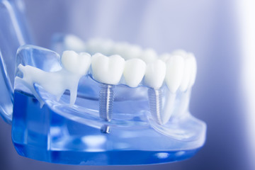 Dental teeth dentistry model