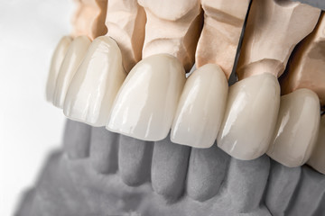 Row of teeth prosthesis
