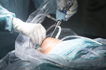 Knee surgery hospital operation
