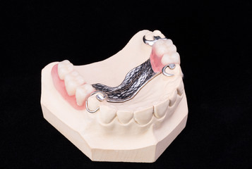Denture, lower jaw