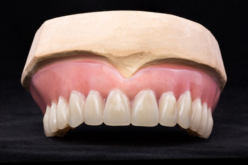 Denture, upper jaw