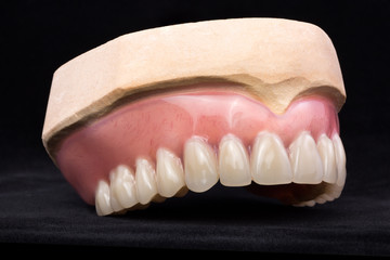 Denture, upper jaw