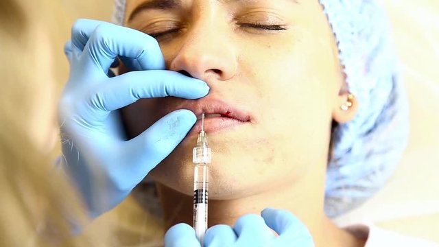 Young woman on lip Augmentation in a clinic. Anesthetic injection Silicone implant lips thickening. botox injection