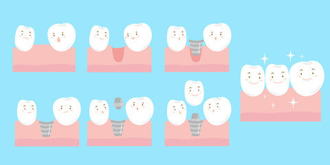 cartoon tooth implant smile happily