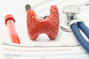 Anatomical model of thyroid gland, stethoscope and blood test results are on doctor table. Concept...