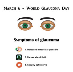 Glaucoma. Symptoms of glaucoma. Atrophy of the optic nerve. Field of view at glaukome.Stroenie eyes. Infographics. 