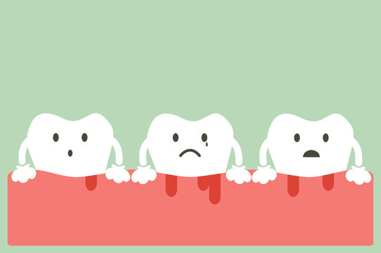 Gingivitis And Bleeding