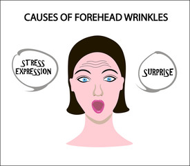 Женское лицо с мимическими морщинами и складками. Схематическое изображение напряженных лицевых мышц