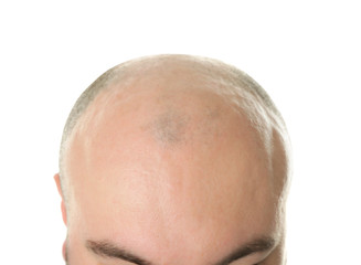 Bald adult man on white background, closeup