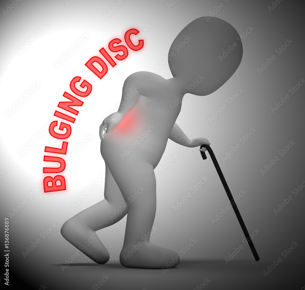Poster bulging disc showing back chiropractor 3d rendering