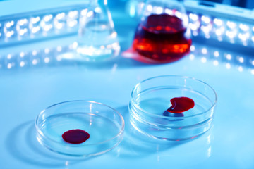 Chemical glassware with blood on blurred background