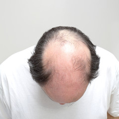 Bald