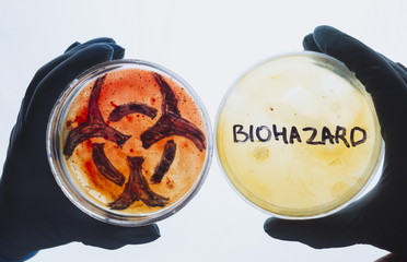 Hands hold Petri dishes with biohazard word symbol sign. Contaminated water food concept. Dangerous infectious disease. Medical lab testing research. Bacterial infection control prevention outbreak