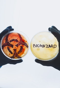 Hands hold Petri dishes with biohazard word symbol sign. Contaminated water food concept. Dangerous infectious disease. Medical lab testing research. Bacterial infection control prevention outbreak