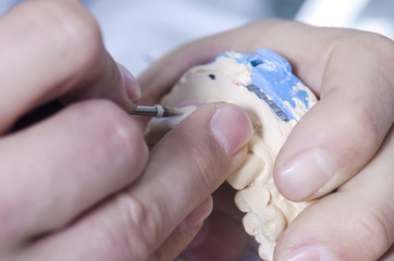 Dental technician working in a metal ceramic crowns