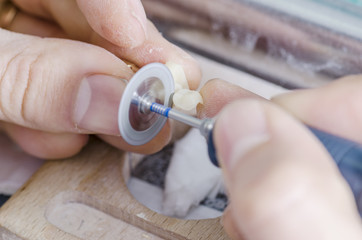 Dental technician cutting a hybrid ceramic crown: composite and