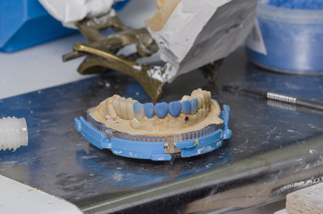 Dental lab technician produces a diagnostic wax-up