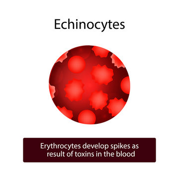 Echinocytes. Erythrocytes develop spikes as result of toxins in the blood. Vector illustration on isolated background