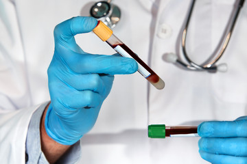 hands doctor holding blood tube in the laboratory / doctor examining two tubes with blood samples...