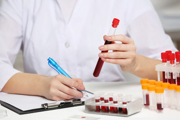 Woman working with blood samples in laboratory, closeup