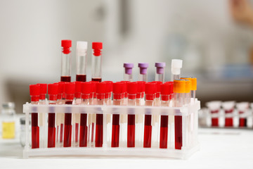 Test tubes with blood samples on table in laboratory