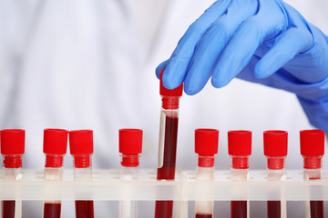 Woman working with blood samples in laboratory, closeup