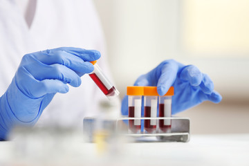 Woman working with blood samples in laboratory, closeup - obrazy, fototapety, plakaty