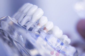 Dentists dental teeth model