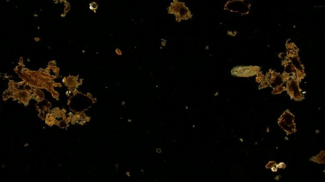 Mikroorganismus im Mikroskop im Dunkelfeld 4K
