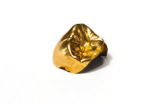 Zahngold Goldzahn Geld Ausgabe Inlay Kosten Versicherung zahn Zusatzversicherung Goldkrone, Zahnmedizin, Zahnmediziner, Zahnarzt,  Zahnmedizin, Kieferorthop&auml;de, Zahnlabor, Dentallabor, dental