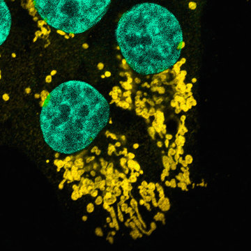 Microscopic image of mutated human epithelial cells