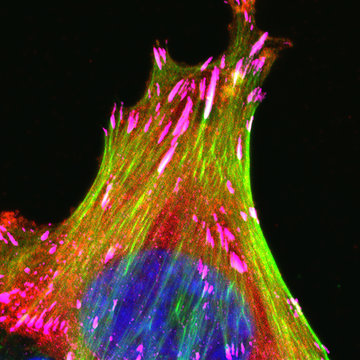Enlarged focal adhesions in breast cancer cells